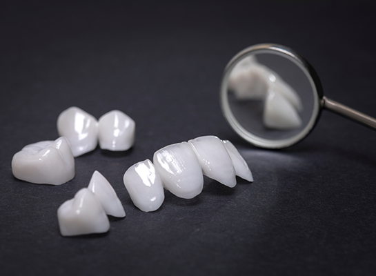 Several white dental crowns and veneers on desk next to dental mirror