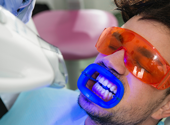 Man in dental chair receiving professional teeth whitening