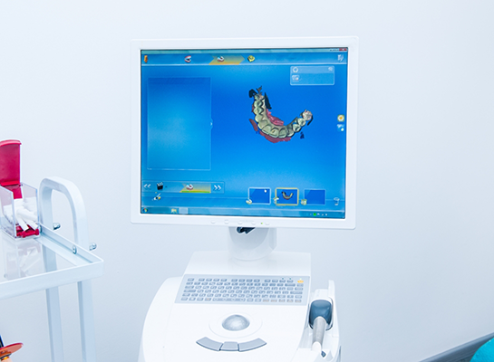 Computer screen showing digital impressions of teeth