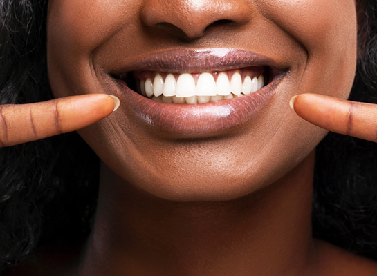 Close up of person pointing to their smile with white teeth