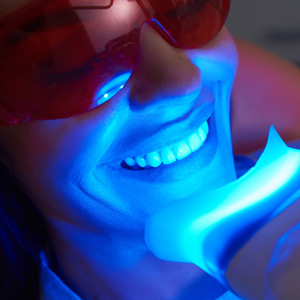 UV light applied to woman’s teeth whitening procedure