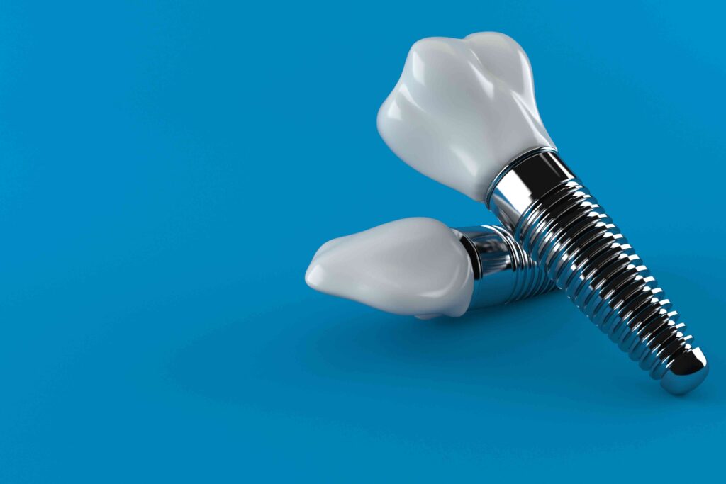 Dental implants on blue background